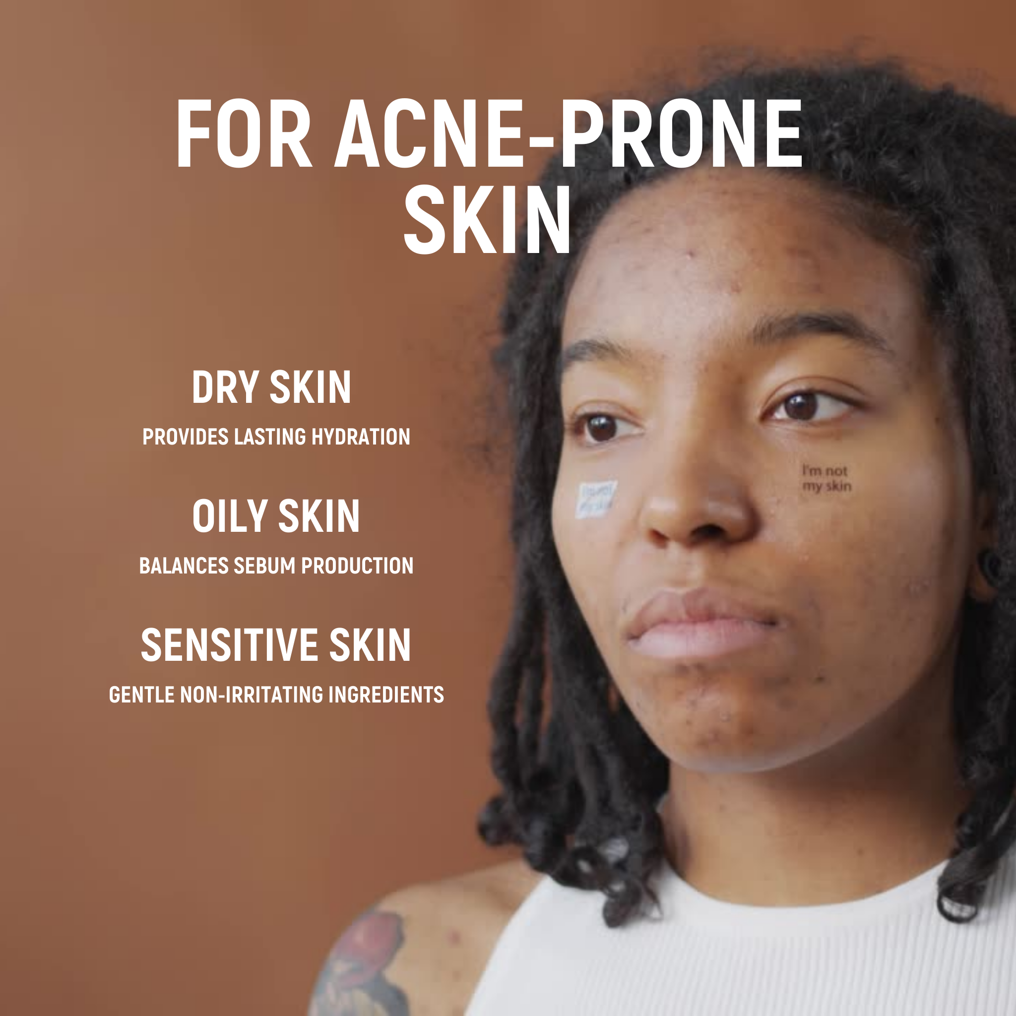 Acne.org.za - HYDRATE - Anti-inflammatory & Deep nourishing moisturiser - Image 6