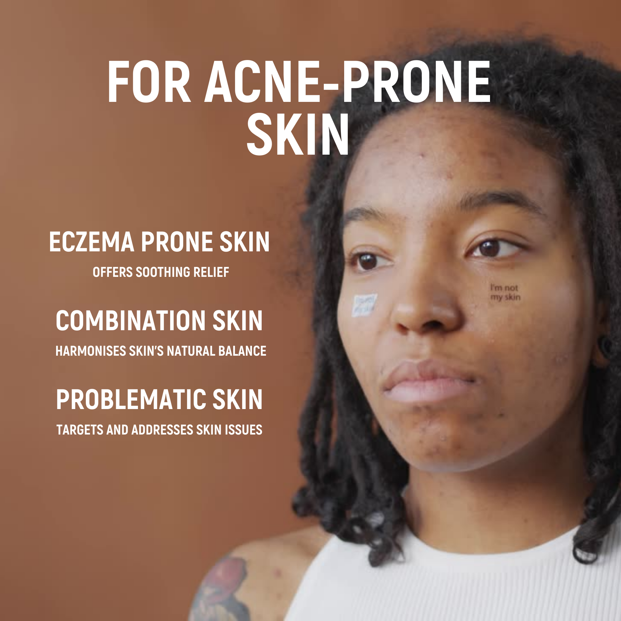 Acne.org.za - HYDRATE - Anti-inflammatory & Deep nourishing moisturiser - Image 7